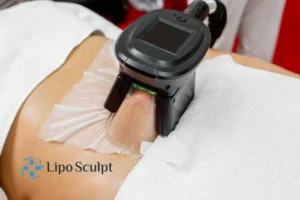 Are The Results From Aqualyx Permanent? 4 Compare Aqualyx Merry Hill to other fat reduction treatments.